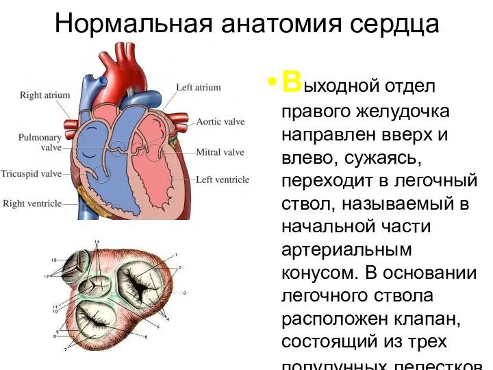 Нормальная анатомия сердца Выходной отдел правого желудочка направлен вверх и влево, сужаясь,