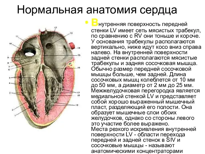 Нормальная анатомия сердца Внутренняя поверхность передней стенки LV имеет сеть мясистых трабекул,
