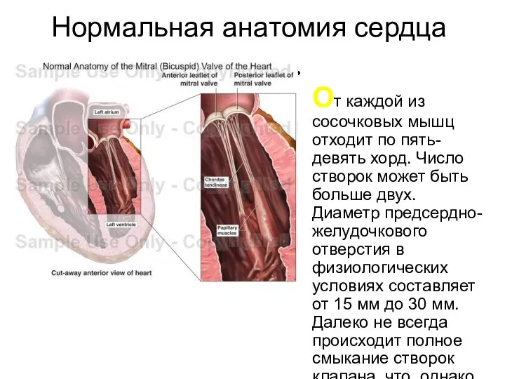 Нормальная анатомия сердца От каждой из сосочковых мышц отходит по пять-девять хорд.