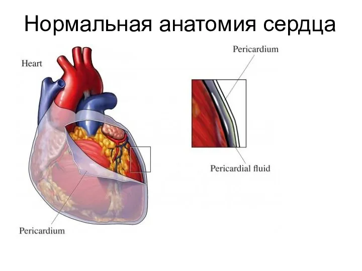 Нормальная анатомия сердца