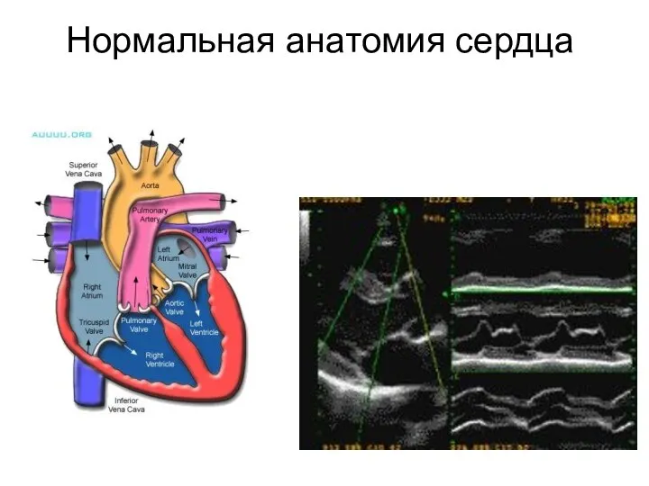 Нормальная анатомия сердца