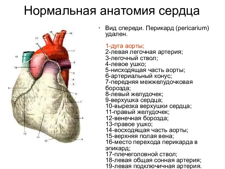 Нормальная анатомия сердца Вид спереди. Перикард (pericarium) удален. 1-дуга аорты; 2-левая легочная