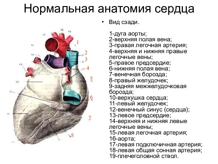 Нормальная анатомия сердца Вид сзади. 1-дуга аорты; 2-верхняя полая вена; 3-правая легочная