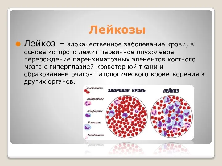 Лейкозы Лейкоз – злокачественное заболевание крови, в основе которого лежит первичное опухолевое