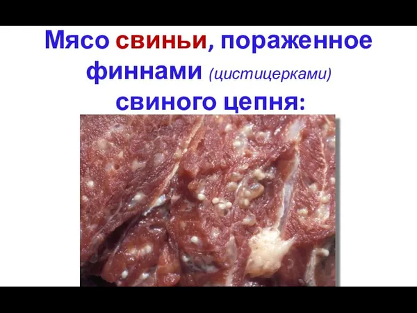 Мясо свиньи, пораженное финнами (цистицерками) свиного цепня: