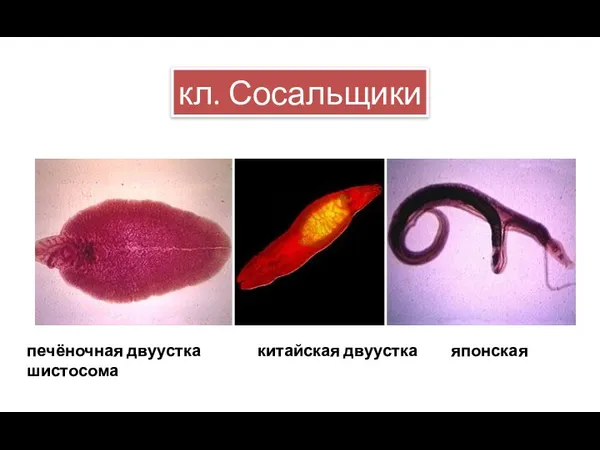 кл. Сосальщики печёночная двуустка китайская двуустка японская шистосома