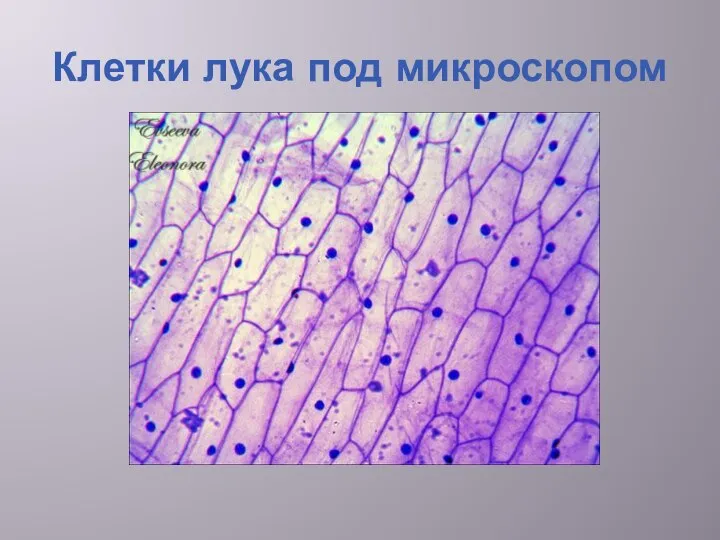 Клетки лука под микроскопом