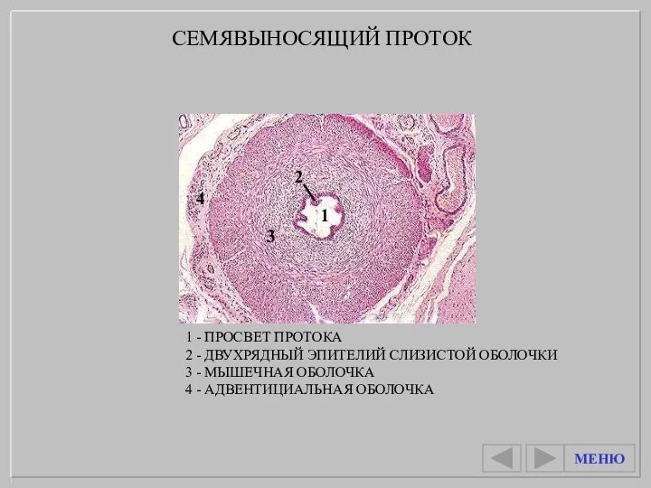 1 - ПРОСВЕТ ПРОТОКА 2 - ДВУХРЯДНЫЙ ЭПИТЕЛИЙ СЛИЗИСТОЙ ОБОЛОЧКИ 3 -