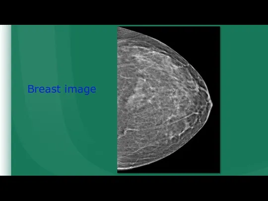 Breast image