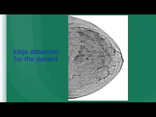 Edge detection for the patient