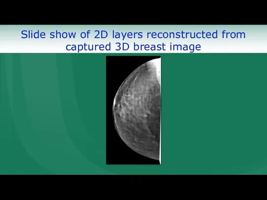 Slide show of 2D layers reconstructed from captured 3D breast image