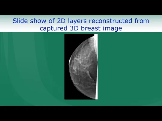Slide show of 2D layers reconstructed from captured 3D breast image