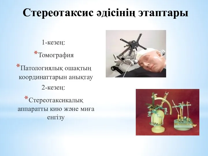 Стереотаксис әдісінің этаптары 1-кезең: Томография Патологиялық ошақтың координаттарын анықтау 2-кезең: Стереотаксикалық аппаратты кию және миға енгізу