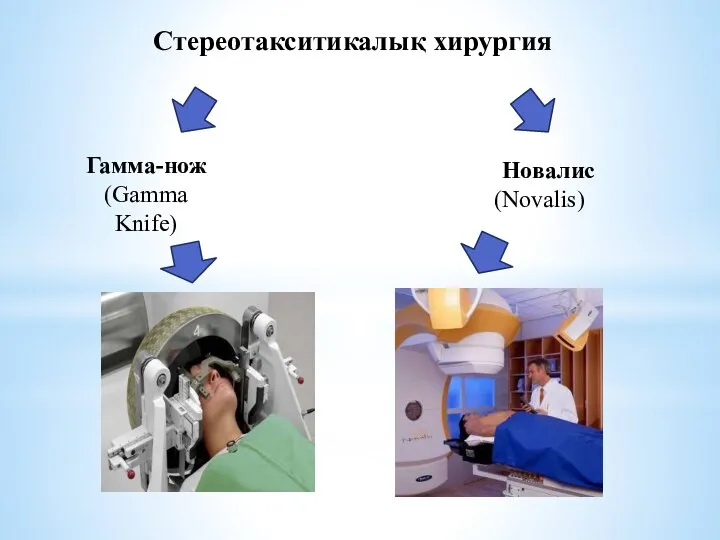 Стереотакситикалық хирургия Гамма-нож (Gamma Knife) Новалис (Novalis)