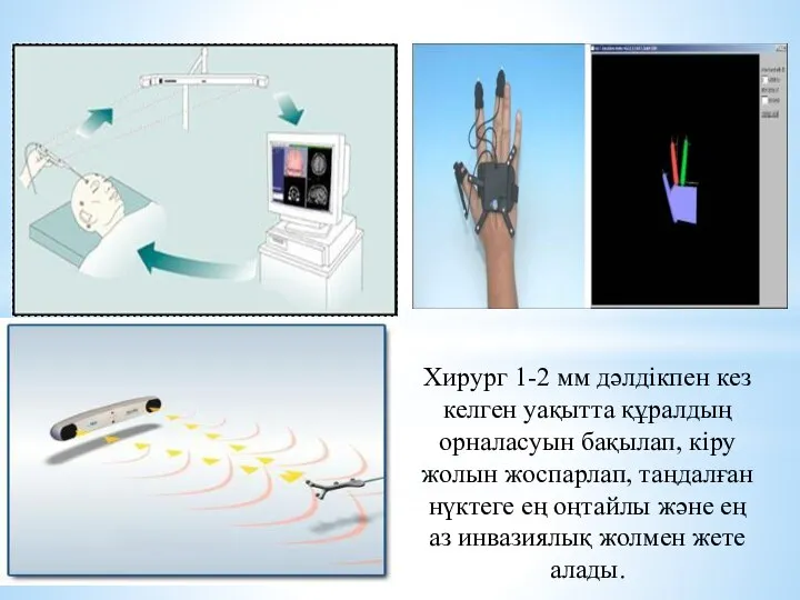 Хирург 1-2 мм дәлдікпен кез келген уақытта құралдың орналасуын бақылап, кіру жолын