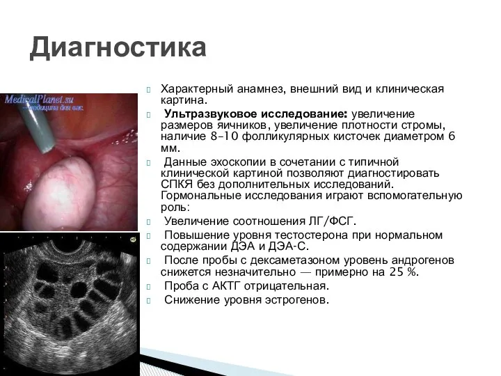 Характерный анамнез, внешний вид и клиническая картина. Ультразвуковое исследование: увеличение размеров яичников,