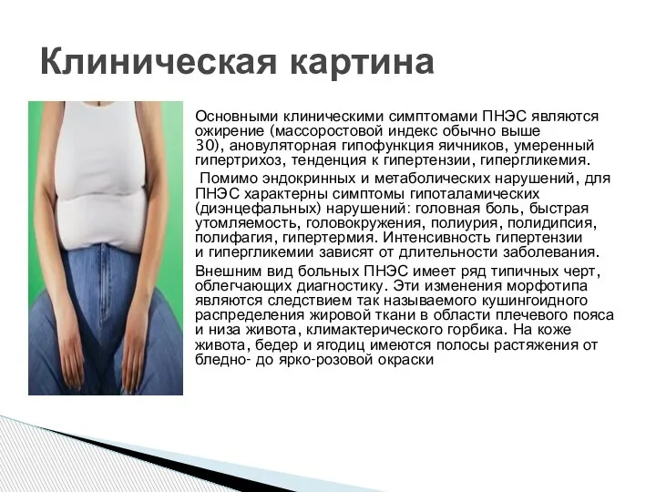 Основными клиническими симптомами ПНЭС являются ожирение (массоростовой индекс обычно выше 30), ановуляторная