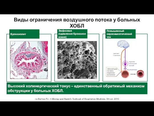 по Barnes PJ. in Murray and Nadel's Textbook of Respiratory Medicine, 5th