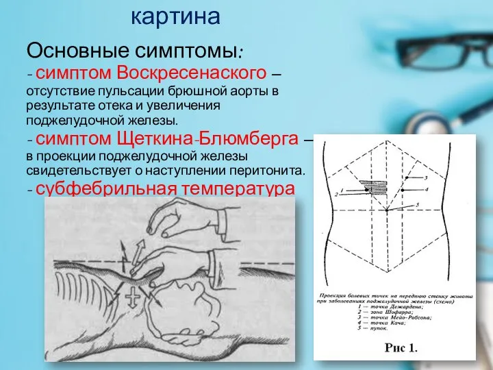 Клиническая картина Основные симптомы: - симптом Воскресенаского – отсутствие пульсации брюшной аорты