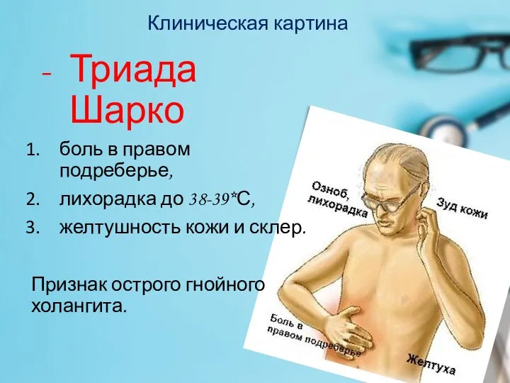 Клиническая картина Триада Шарко боль в правом подреберье, лихорадка до 38-39*С, желтушность