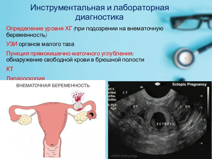 Инструментальная и лабораторная диагностика Определение уровня ХГ (при подозрении на внематочную беременность)