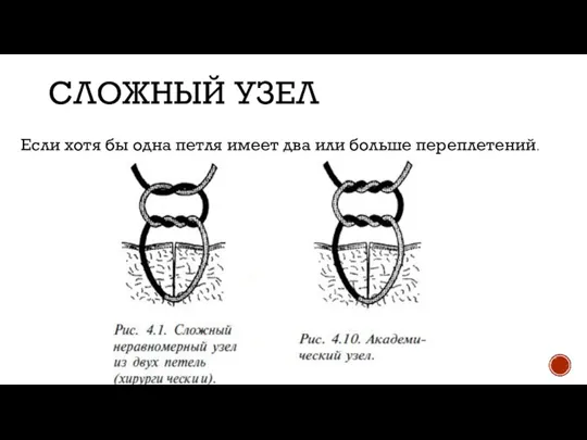 СЛОЖНЫЙ УЗЕЛ Если хотя бы одна петля имеет два или больше переплетений.