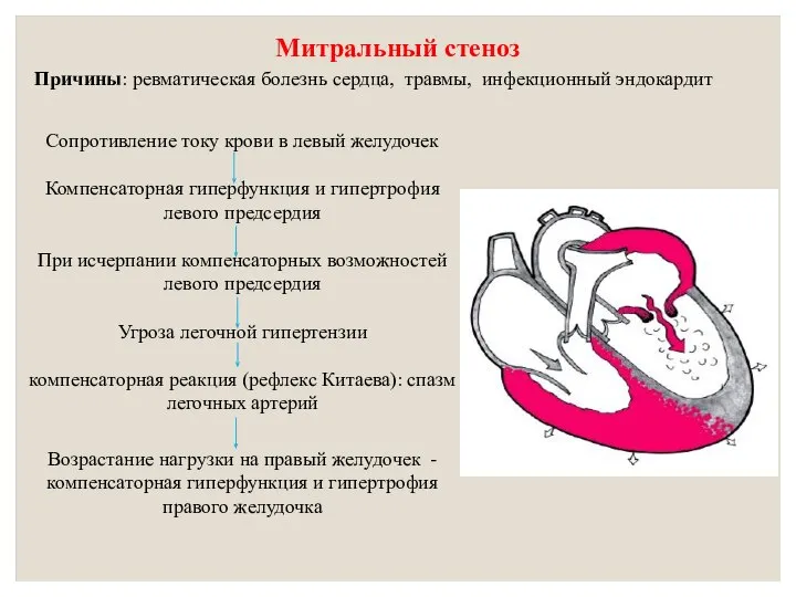 Митральный стеноз Причины: ревматическая болезнь сердца, травмы, инфекционный эндокардит Сопротивление току крови