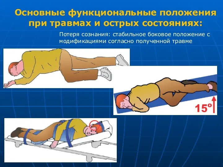 Потеря сознания: стабильное боковое положение с модификациями согласно полученной травме Основные функциональные