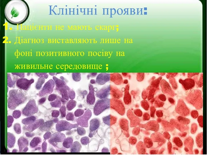 Клінічні прояви: 1. Пацієнти не мають скарг; 2. Діагноз виставляють лише на