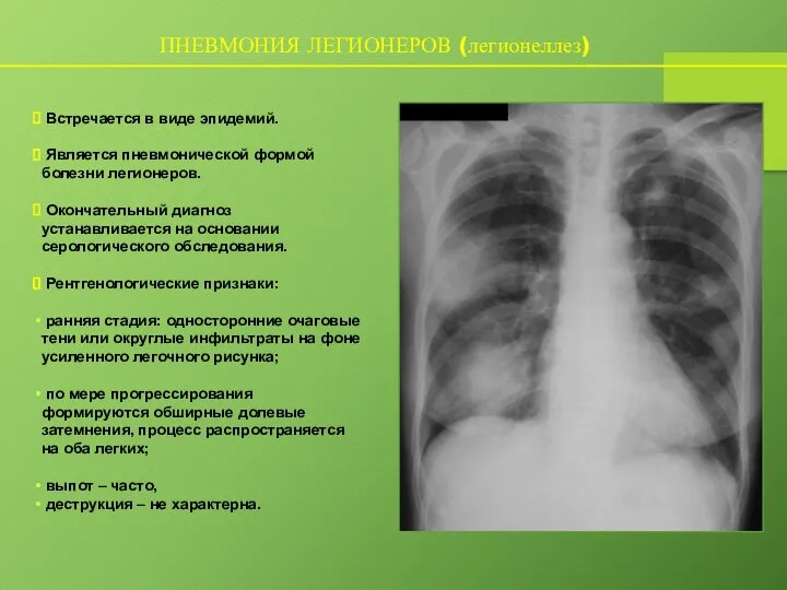 ПНЕВМОНИЯ ЛЕГИОНЕРОВ (легионеллез) Встречается в виде эпидемий. Является пневмонической формой болезни легионеров.