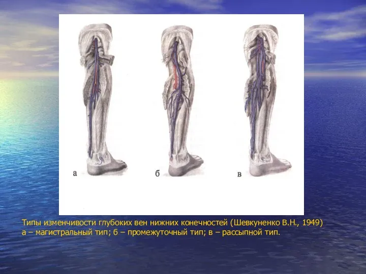 Типы изменчивости глубоких вен нижних конечностей (Шевкуненко В.Н., 1949) а – магистральный