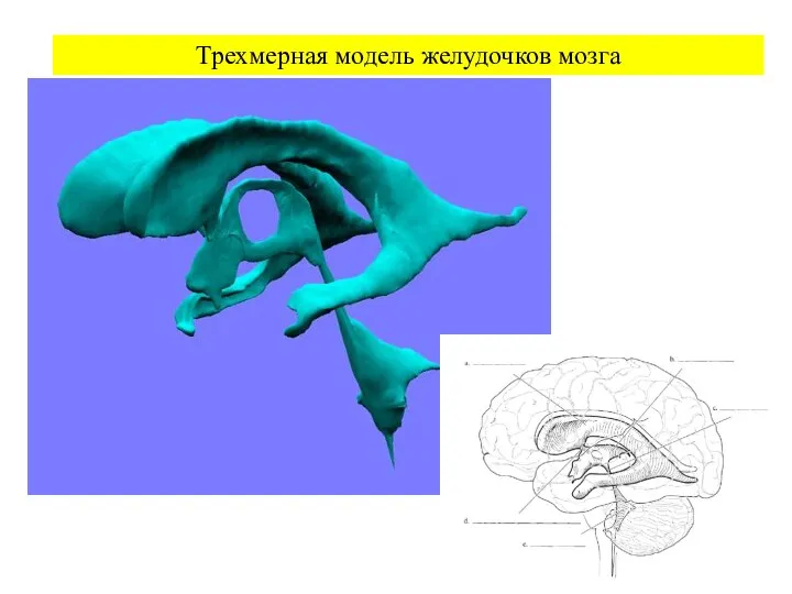 Трехмерная модель желудочков мозга