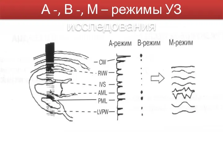 А -, В -, М – режимы УЗ исследования