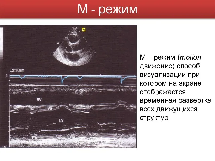 М - режим М – режим (motion - движение) способ визуализации при