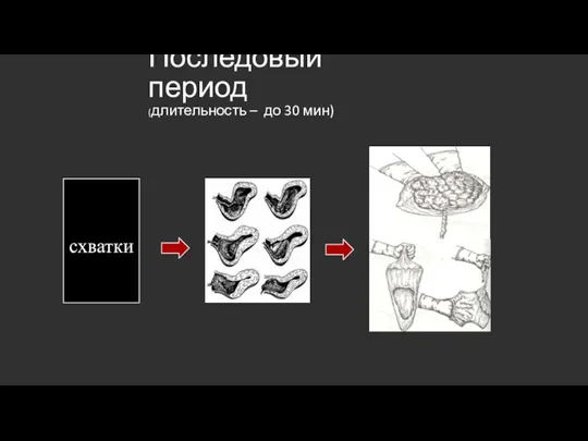 Последовый период (длительность – до 30 мин) схватки