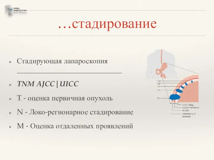 …стадирование Стадирующая лапароскопия ____________________________ TNM AJCC|UICC T - оценка первичная опухоль N