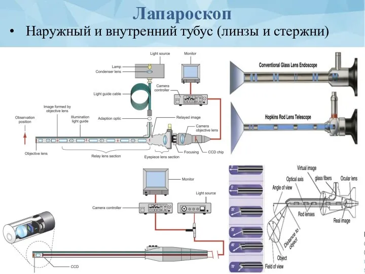 Лапароскоп Наружный и внутренний тубус (линзы и стержни)