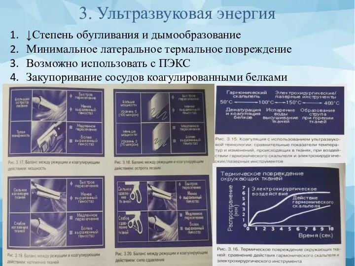 3. Ультразвуковая энергия ↓Степень обугливания и дымообразование Минимальное латеральное термальное повреждение Возможно