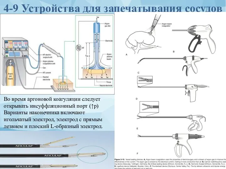 4-9 Устройства для запечатывания сосудов Во время аргоновой коагуляции следует открывать инсуффляционный