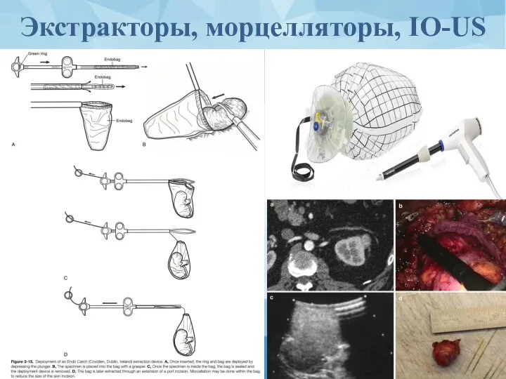 Экстракторы, морцелляторы, IO-US