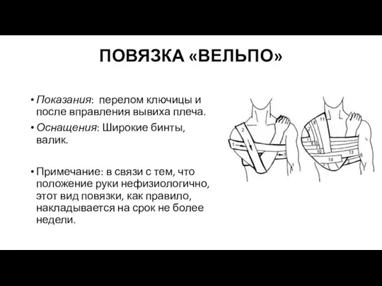 ПОВЯЗКА «ВЕЛЬПО» Показания: перелом ключицы и после вправления вывиха плеча. Оснащения: Широкие