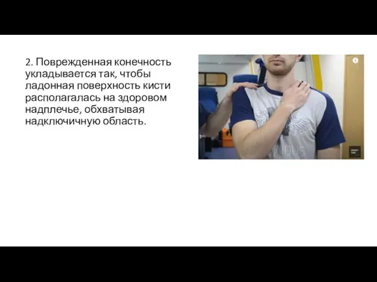 2. Поврежденная конечность укладывается так, чтобы ладонная поверхность кисти располагалась на здоровом надплечье, обхватывая надключичную область.