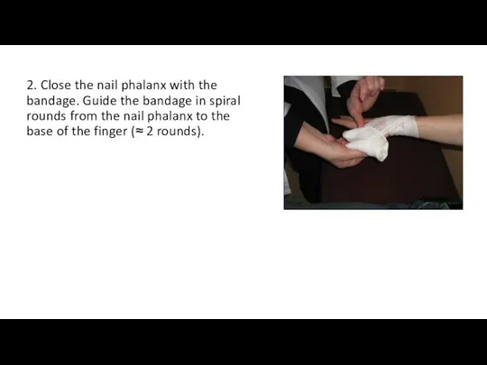 2. Close the nail phalanx with the bandage. Guide the bandage in