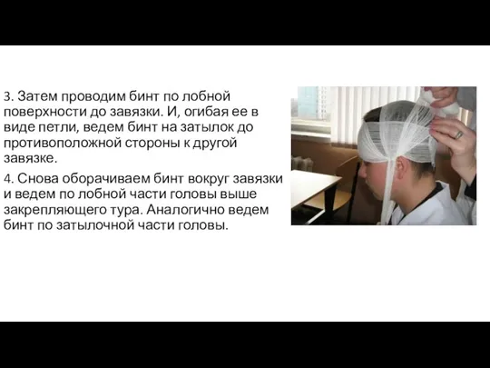 3. Затем проводим бинт по лобной поверхности до завязки. И, огибая ее