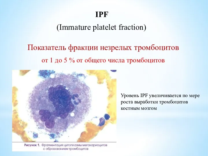 IPF Показатель фракции незрелых тромбоцитов (Immature platelet fraction) от 1 до 5