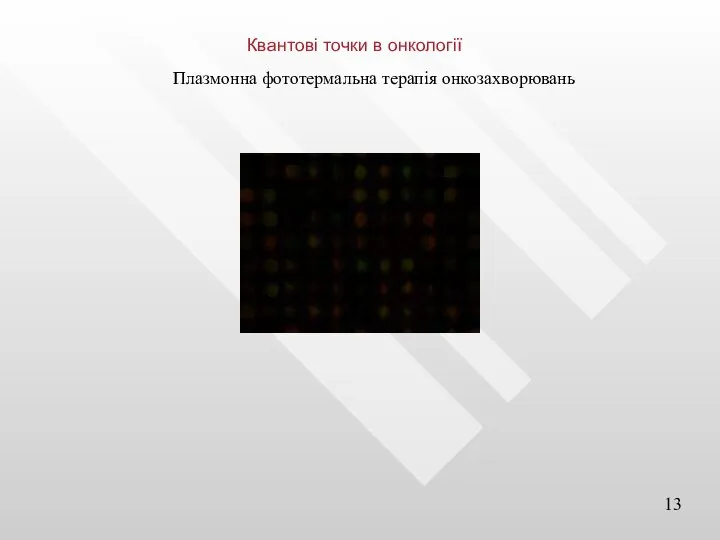 Квантові точки в онкології Плазмонна фототермальна терапія онкозахворювань