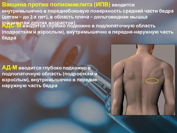 Вакцина против полиомиелита (ИПВ) вводится внутримышечно в переднебоковую поверхность средней части бедра