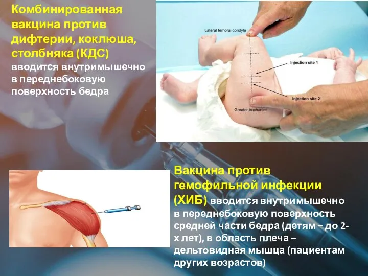 Комбинированная вакцина против дифтерии, коклюша, столбняка (КДС) вводится внутримышечно в переднебоковую поверхность