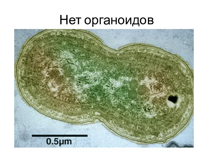 Нет органоидов