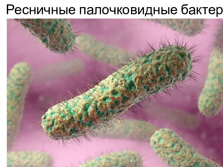Ресничные палочковидные бактерии.